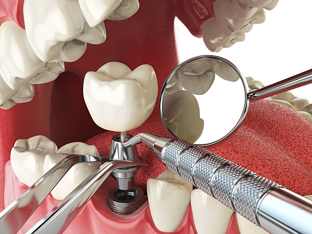 Best Emergency Orthodontic Repairs in Johnstown, CO